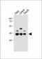 BCKDHB Antibody (N-term)